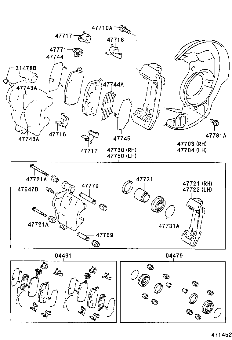 04465-20180 PAD KIT, DISC BRAKE, FRONT product image